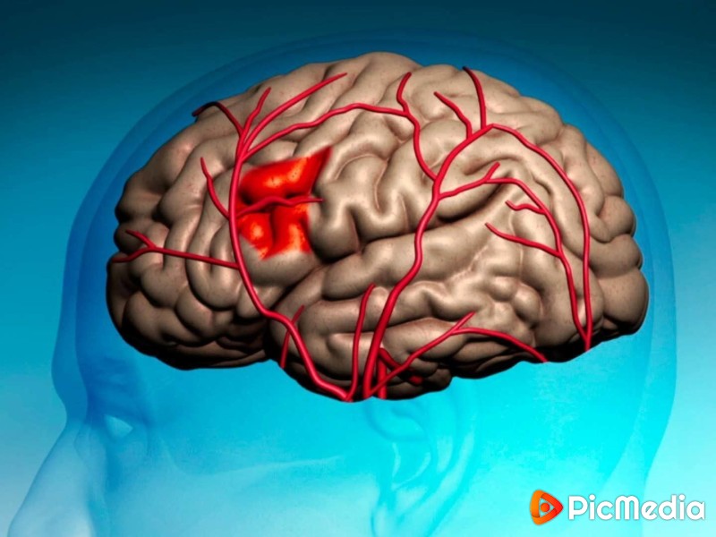 Как очистить сосуды головного мозга?